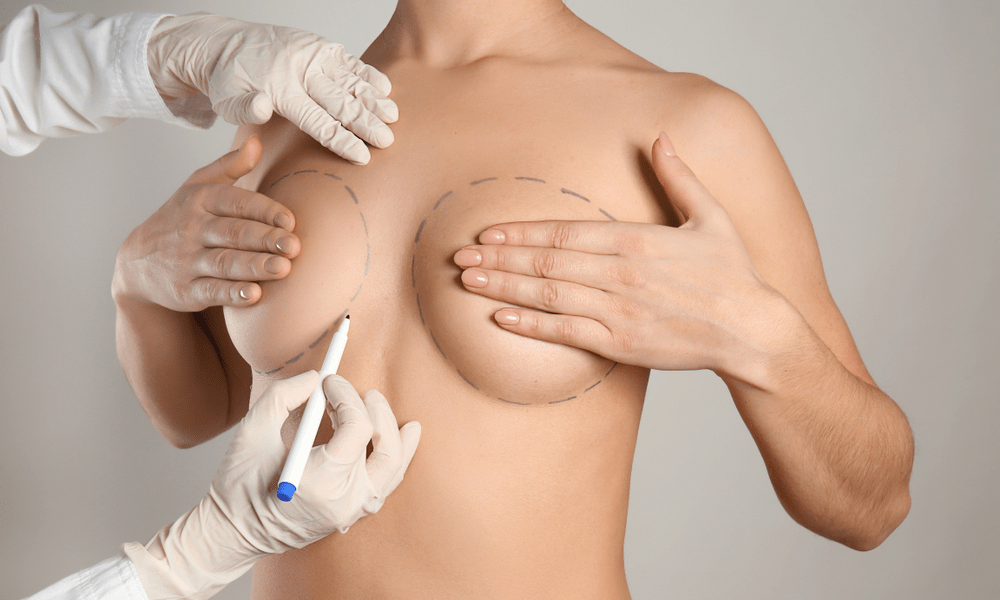 Chirurgie esthétique mammoplastie Tunisie prix : Guide complet