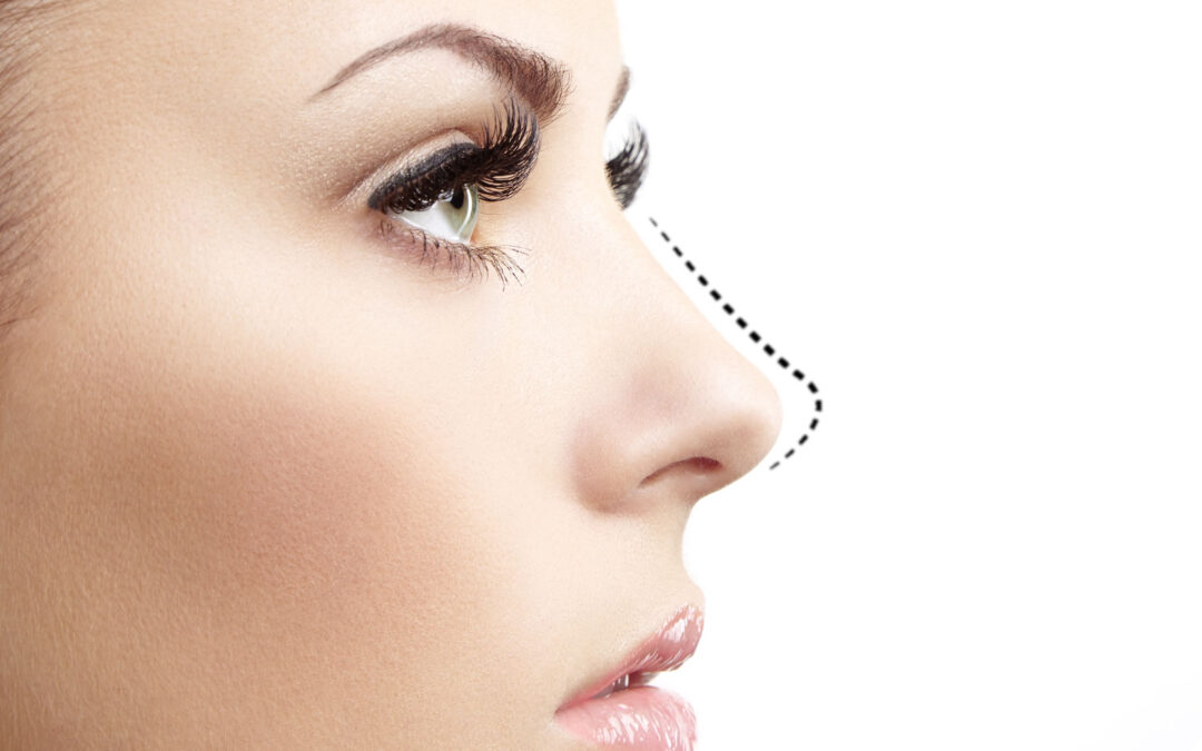 Rhinoplastie Barbie en Tunisie : Guide complet pour un nez raffiné et harmonieux