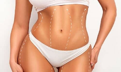 Avez-vous besoin de plasma J après une liposuccion  ?