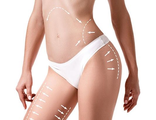 Liposuccion 8 HD en Tunisie : Tout savoir sur cette technique de haute définition