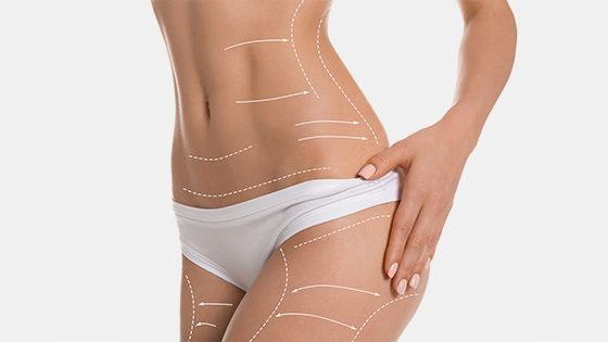 Liposuccion et Lipofilling : Remodeler et Augmenter Certaines Zones du Corps