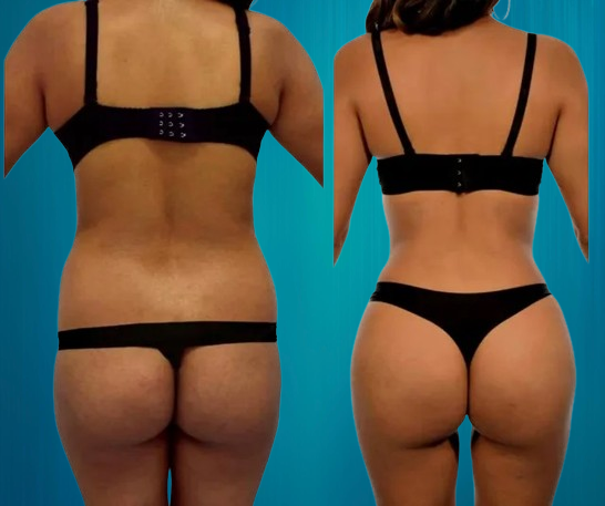 résultats du RibXCar Tunisie