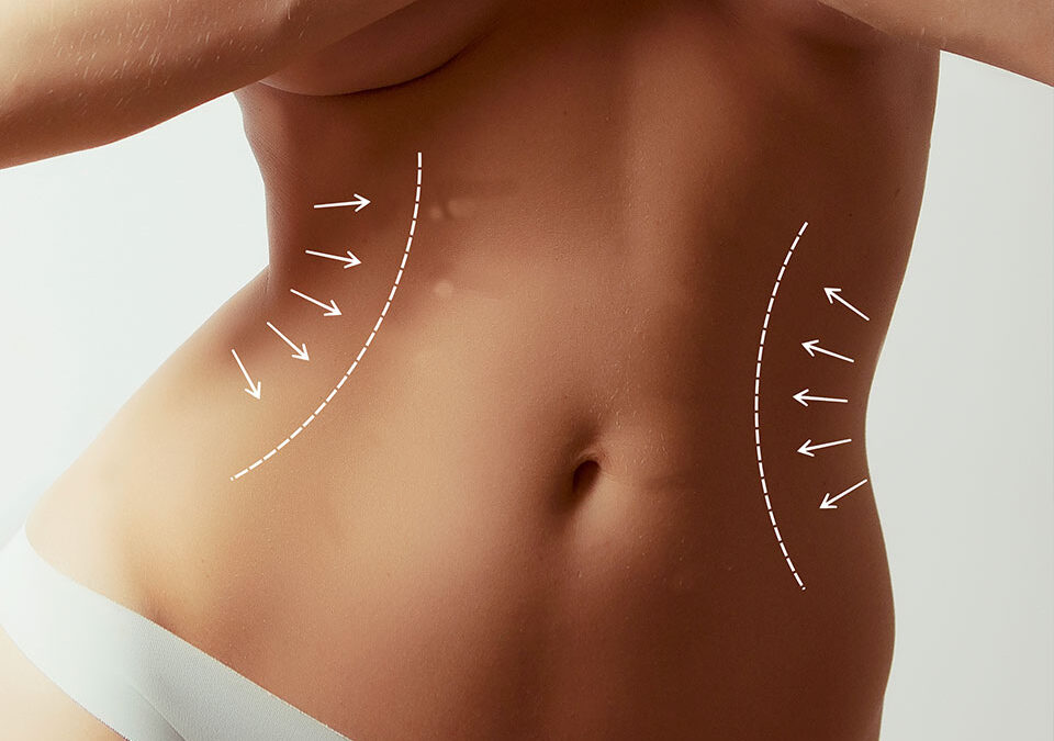 RibXCar : Remodelage Costal Avancé Sans Cicatrice en Tunisie par Dr GAM