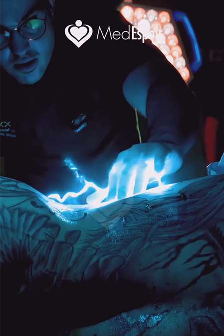 Body Contouring Academy met à l’honneur le Dr Youssef GAM, expert du RibXcar en Tunisie