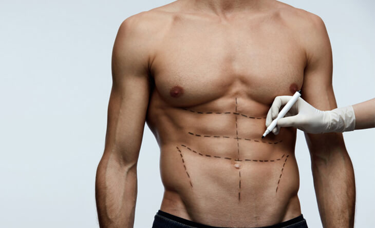 U-Graft en Tunisie : des abdos sculptés naturellement avec le Dr Gam