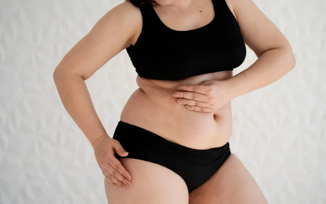 Pourquoi le lipœdème s’aggrave-t-il à la puberté, pendant la grossesse et à la ménopause ?